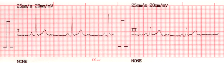 ecg-print-1x12.png ecg-print-1x12.png
