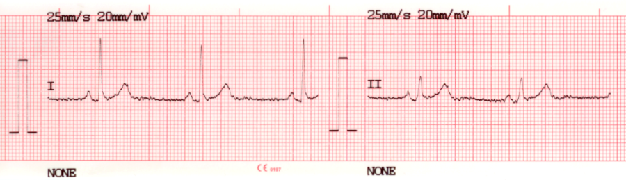 ecg-print-1x12.png