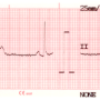 ecg-print-1x12.png