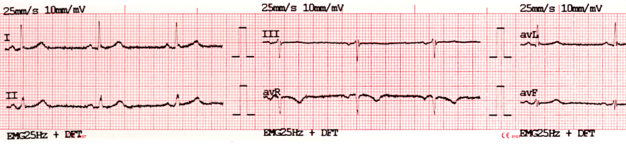 ecg-print-2x6.png