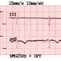 ecg-print-2x6.png