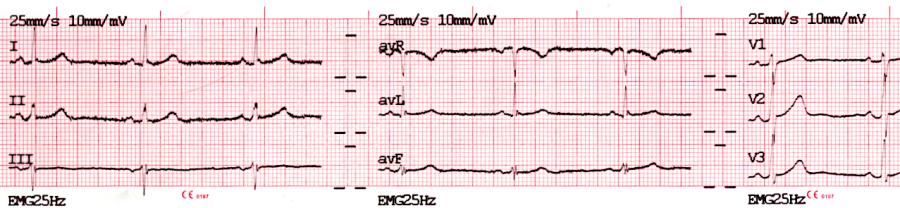 ecg-print-3x4.png