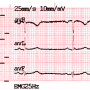 ecg-print-3x4.png