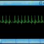 ecg90a_01-tracks.jpg