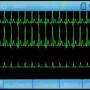 ecg90a_03-tracks.jpg