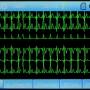 ecg90a_06-tracks.jpg