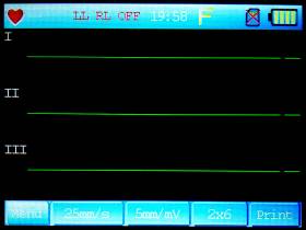 Schermata ECG
