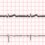 ecg90a_filter-dft.png