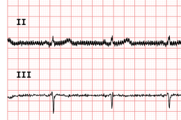 ECG90A - Filtri DFT