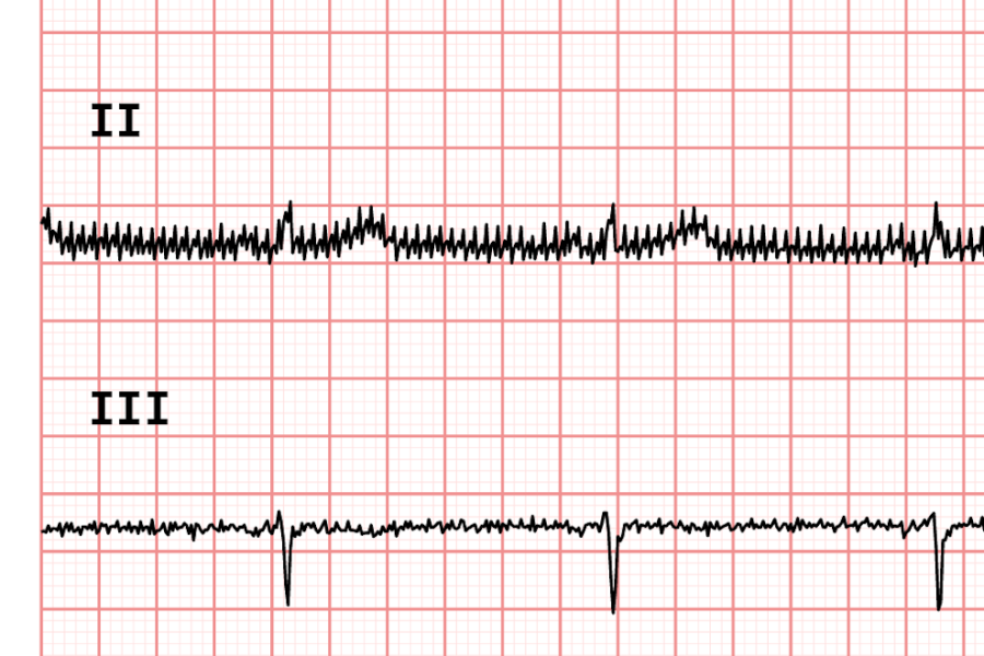 ecg90a_filter-none.png