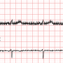 ecg90a_filter-none.png