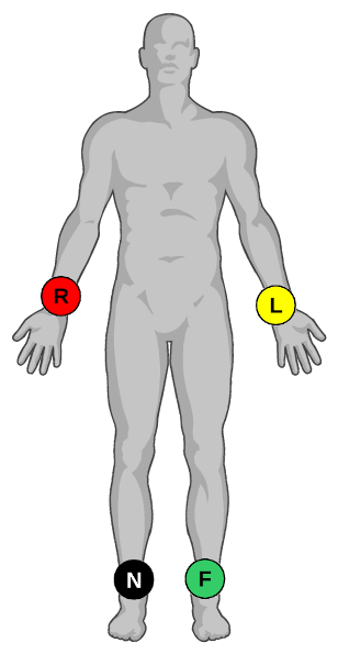 elettrodi-periferici.png