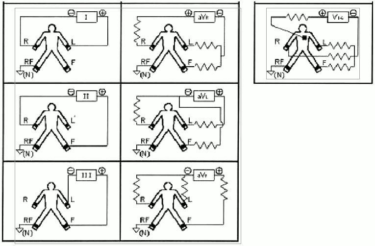 leads-scheme.png leads-scheme.png