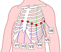 Posizione elettrodi precordiali (da commons.wikimedia.org: Precordial_Leads_2.svg